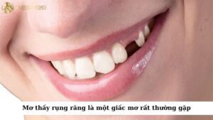 Mơ thấy rụng răng là một giấc mơ rất thường gặp